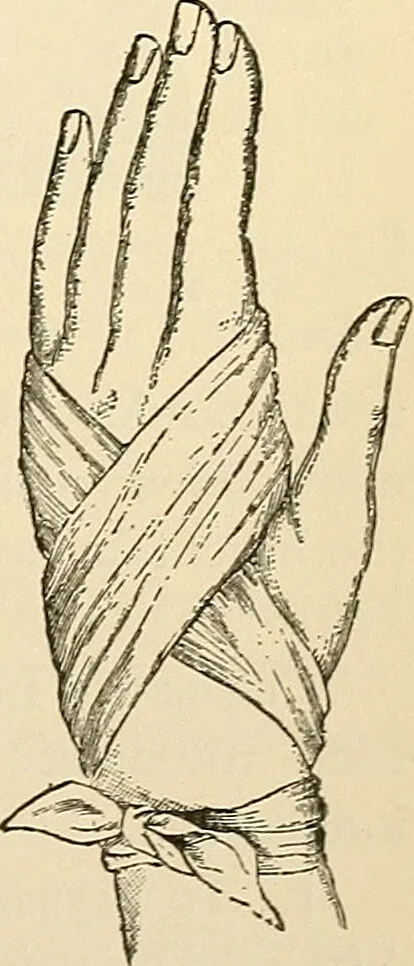 An illustration from Surgical technic; a text-book on operative surgery / by Fr. von Esmarch ... and E. Kowalzig ... translated by Professor Ludwig H. Grau ... and Willam N. Sullivan ... edited by Nicholas Senn ... With fourteen hundred and ninety-seven illustrations and fifteen colored plates., 1901, leaf 131