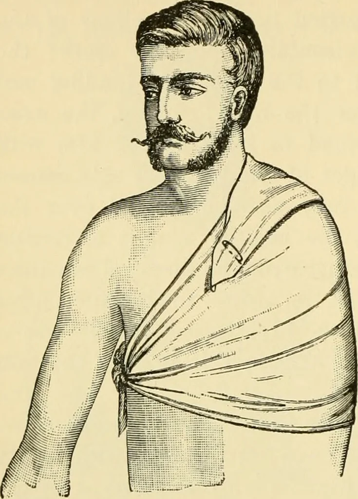 An illustration from Surgical technic; a text-book on operative surgery / by Fr. von Esmarch ... and E. Kowalzig ... translated by Professor Ludwig H. Grau ... and Willam N. Sullivan ... edited by Nicholas Senn ... With fourteen hundred and ninety-seven illustrations and fifteen colored plates., 1901, leaf 134