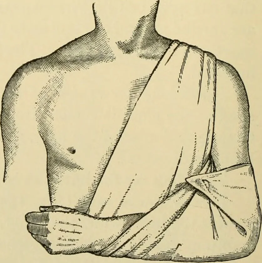An illustration from Surgical technic; a text-book on operative surgery / by Fr. von Esmarch ... and E. Kowalzig ... translated by Professor Ludwig H. Grau ... and Willam N. Sullivan ... edited by Nicholas Senn ... With fourteen hundred and ninety-seven illustrations and fifteen colored plates., 1901, leaf 134