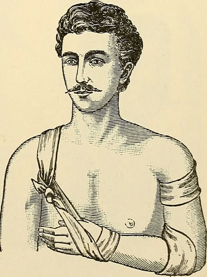 An illustration from Surgical technic; a text-book on operative surgery / by Fr. von Esmarch ... and E. Kowalzig ... translated by Professor Ludwig H. Grau ... and Willam N. Sullivan ... edited by Nicholas Senn ... With fourteen hundred and ninety-seven illustrations and fifteen colored plates., 1901, leaf 135
