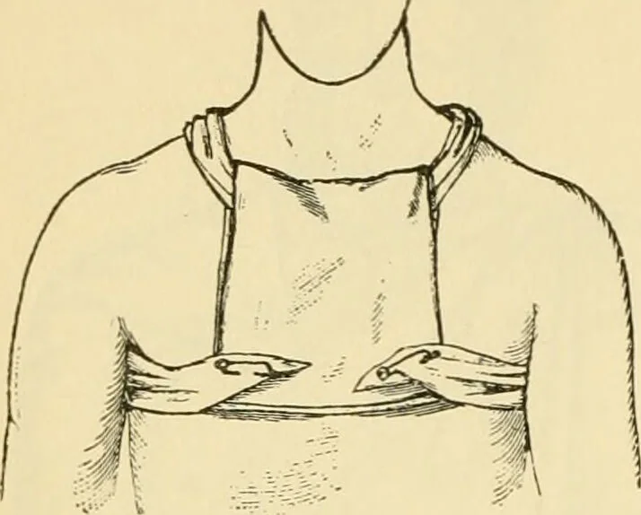 An illustration from Surgical technic; a text-book on operative surgery / by Fr. von Esmarch ... and E. Kowalzig ... translated by Professor Ludwig H. Grau ... and Willam N. Sullivan ... edited by Nicholas Senn ... With fourteen hundred and ninety-seven illustrations and fifteen colored plates., 1901, leaf 136