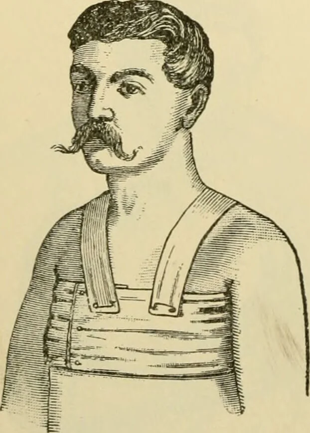 An illustration from Surgical technic; a text-book on operative surgery / by Fr. von Esmarch ... and E. Kowalzig ... translated by Professor Ludwig H. Grau ... and Willam N. Sullivan ... edited by Nicholas Senn ... With fourteen hundred and ninety-seven illustrations and fifteen colored plates., 1901, leaf 136
