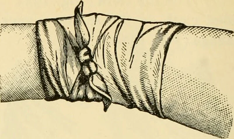 An illustration from Surgical technic; a text-book on operative surgery / by Fr. von Esmarch ... and E. Kowalzig ... translated by Professor Ludwig H. Grau ... and Willam N. Sullivan ... edited by Nicholas Senn ... With fourteen hundred and ninety-seven illustrations and fifteen colored plates., 1901, leaf 138