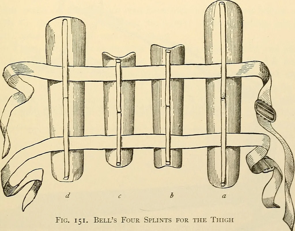 An illustration from Surgical technic; a text-book on operative surgery / by Fr. von Esmarch ... and E. Kowalzig ... translated by Professor Ludwig H. Grau ... and Willam N. Sullivan ... edited by Nicholas Senn ... With fourteen hundred and ninety-seven illustrations and fifteen colored plates., 1901, leaf 143
