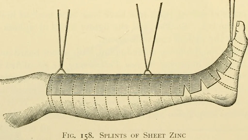 An illustration from Surgical technic; a text-book on operative surgery / by Fr. von Esmarch ... and E. Kowalzig ... translated by Professor Ludwig H. Grau ... and Willam N. Sullivan ... edited by Nicholas Senn ... With fourteen hundred and ninety-seven illustrations and fifteen colored plates., 1901, leaf 146