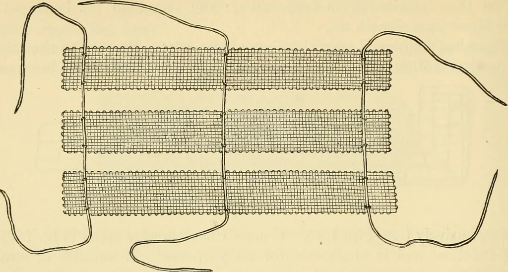 An illustration from Surgical technic; a text-book on operative surgery / by Fr. von Esmarch ... and E. Kowalzig ... translated by Professor Ludwig H. Grau ... and Willam N. Sullivan ... edited by Nicholas Senn ... With fourteen hundred and ninety-seven illustrations and fifteen colored plates., 1901, leaf 148