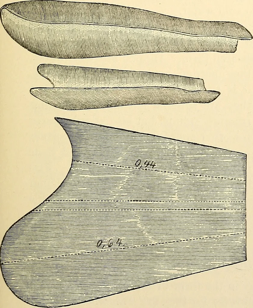 An illustration from Surgical technic; a text-book on operative surgery / by Fr. von Esmarch ... and E. Kowalzig ... translated by Professor Ludwig H. Grau ... and Willam N. Sullivan ... edited by Nicholas Senn ... With fourteen hundred and ninety-seven illustrations and fifteen colored plates., 1901, leaf 153