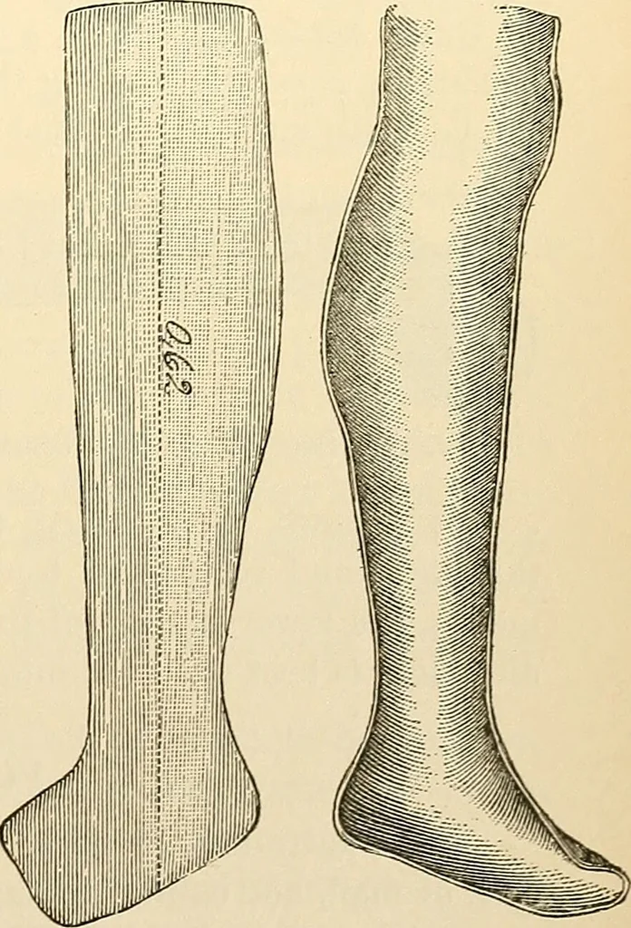 An illustration from Surgical technic; a text-book on operative surgery / by Fr. von Esmarch ... and E. Kowalzig ... translated by Professor Ludwig H. Grau ... and Willam N. Sullivan ... edited by Nicholas Senn ... With fourteen hundred and ninety-seven illustrations and fifteen colored plates., 1901, leaf 153