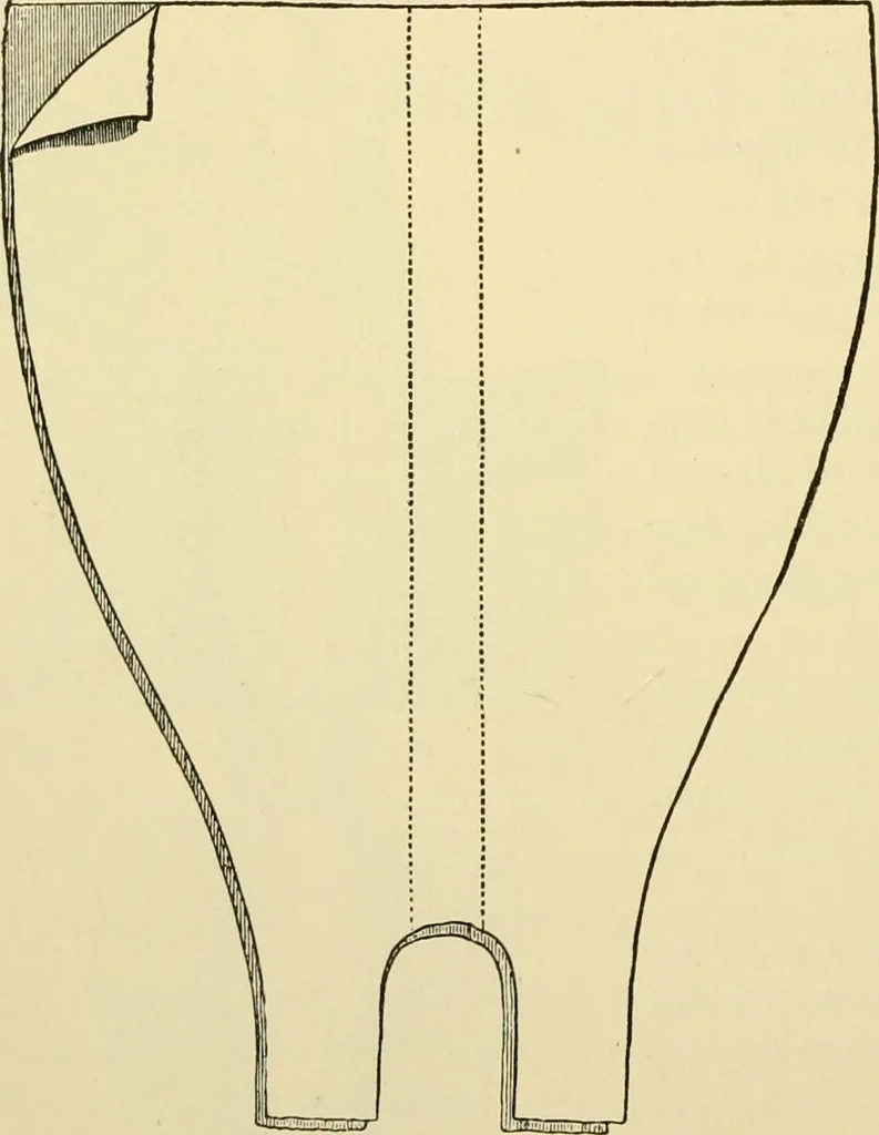 An illustration from Surgical technic; a text-book on operative surgery / by Fr. von Esmarch ... and E. Kowalzig ... translated by Professor Ludwig H. Grau ... and Willam N. Sullivan ... edited by Nicholas Senn ... With fourteen hundred and ninety-seven illustrations and fifteen colored plates., 1901, leaf 158