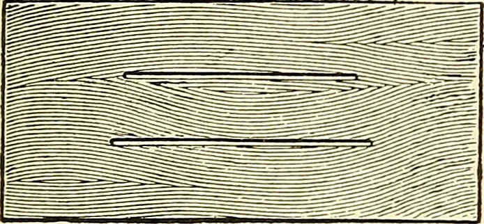 An illustration from Surgical technic; a text-book on operative surgery / by Fr. von Esmarch ... and E. Kowalzig ... translated by Professor Ludwig H. Grau ... and Willam N. Sullivan ... edited by Nicholas Senn ... With fourteen hundred and ninety-seven illustrations and fifteen colored plates., 1901, leaf 159