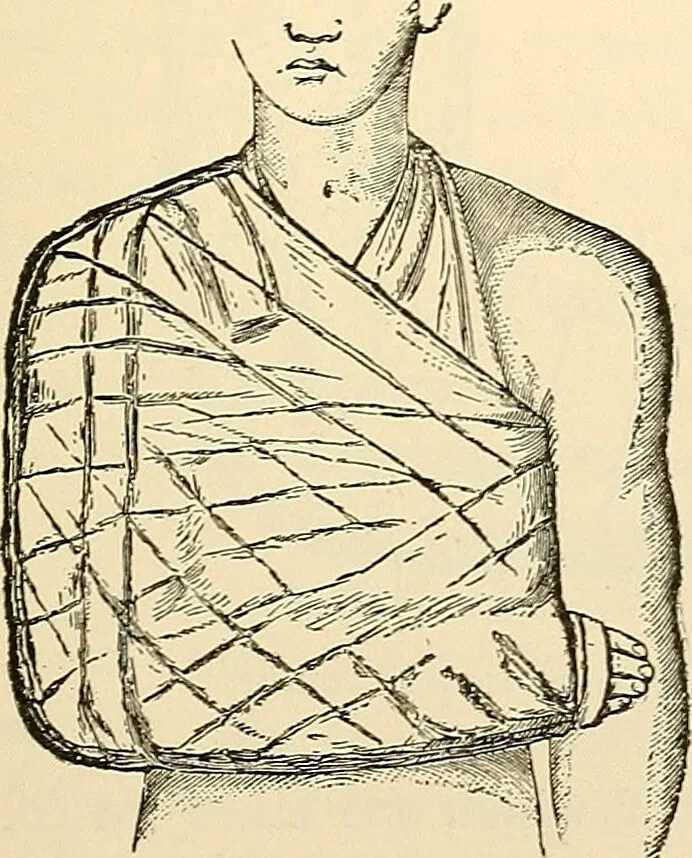 An illustration from Surgical technic; a text-book on operative surgery / by Fr. von Esmarch ... and E. Kowalzig ... translated by Professor Ludwig H. Grau ... and Willam N. Sullivan ... edited by Nicholas Senn ... With fourteen hundred and ninety-seven illustrations and fifteen colored plates., 1901, leaf 165