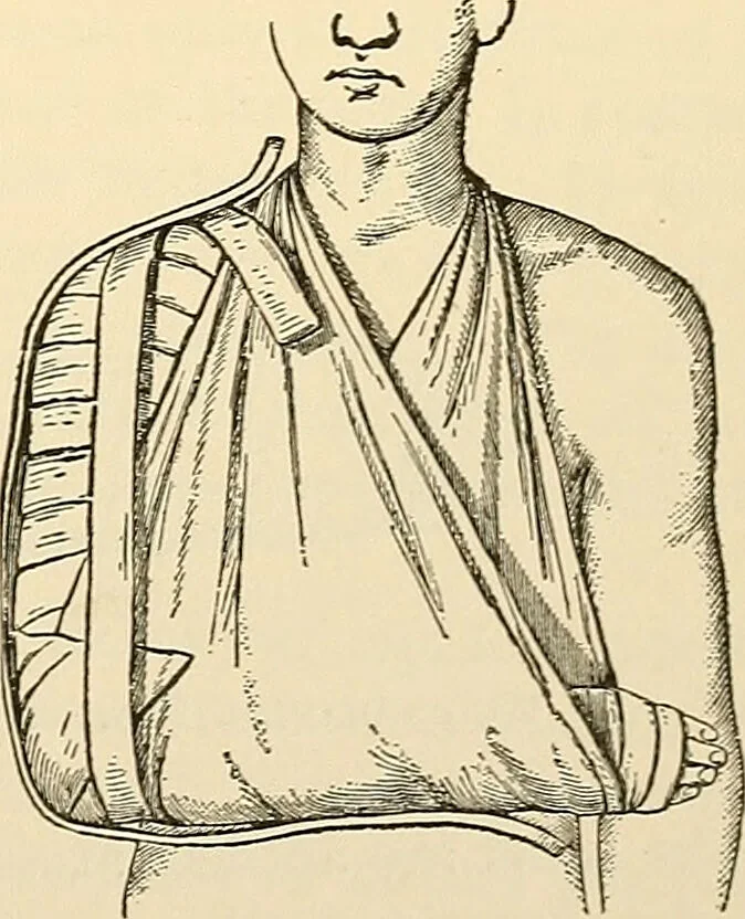 An illustration from Surgical technic; a text-book on operative surgery / by Fr. von Esmarch ... and E. Kowalzig ... translated by Professor Ludwig H. Grau ... and Willam N. Sullivan ... edited by Nicholas Senn ... With fourteen hundred and ninety-seven illustrations and fifteen colored plates., 1901, leaf 165