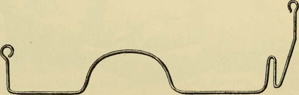 An illustration from Surgical technic; a text-book on operative surgery / by Fr. von Esmarch ... and E. Kowalzig ... translated by Professor Ludwig H. Grau ... and Willam N. Sullivan ... edited by Nicholas Senn ... With fourteen hundred and ninety-seven illustrations and fifteen colored plates., 1901, leaf 174