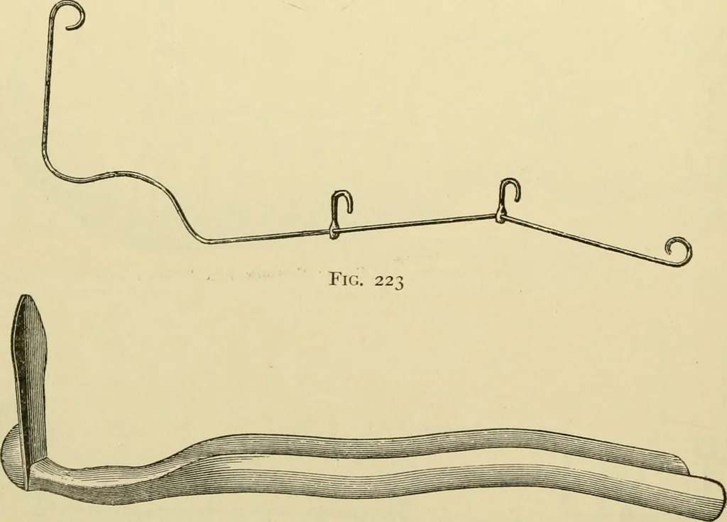 An illustration from Surgical technic; a text-book on operative surgery / by Fr. von Esmarch ... and E. Kowalzig ... translated by Professor Ludwig H. Grau ... and Willam N. Sullivan ... edited by Nicholas Senn ... With fourteen hundred and ninety-seven illustrations and fifteen colored plates., 1901, leaf 176