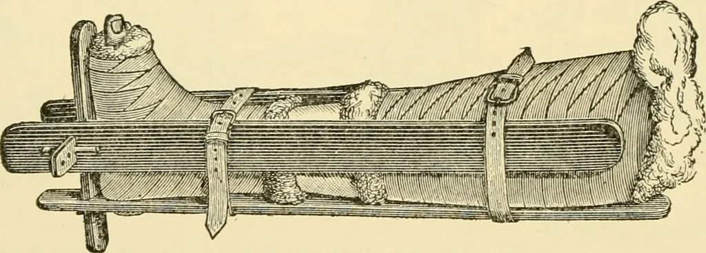An illustration from Surgical technic; a text-book on operative surgery / by Fr. von Esmarch ... and E. Kowalzig ... translated by Professor Ludwig H. Grau ... and Willam N. Sullivan ... edited by Nicholas Senn ... With fourteen hundred and ninety-seven illustrations and fifteen colored plates., 1901, leaf 188