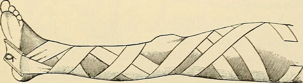 An illustration from Surgical technic; a text-book on operative surgery / by Fr. von Esmarch ... and E. Kowalzig ... translated by Professor Ludwig H. Grau ... and Willam N. Sullivan ... edited by Nicholas Senn ... With fourteen hundred and ninety-seven illustrations and fifteen colored plates., 1901, leaf 193