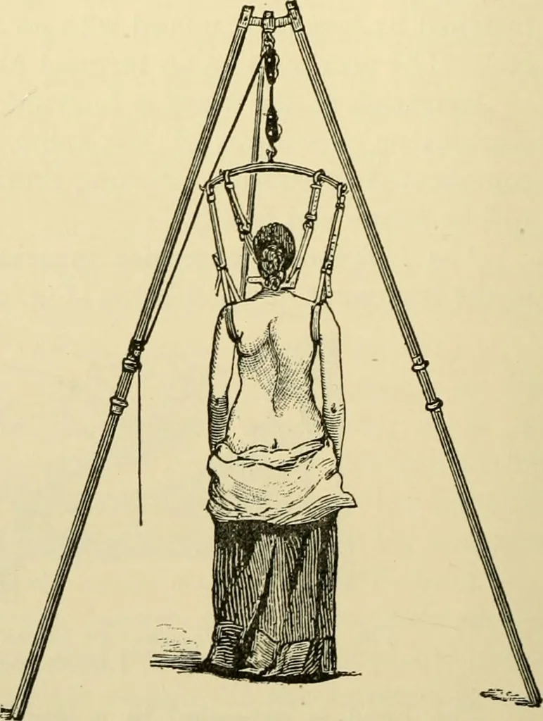 An illustration from Surgical technic; a text-book on operative surgery / by Fr. von Esmarch ... and E. Kowalzig ... translated by Professor Ludwig H. Grau ... and Willam N. Sullivan ... edited by Nicholas Senn ... With fourteen hundred and ninety-seven illustrations and fifteen colored plates., 1901, leaf 196