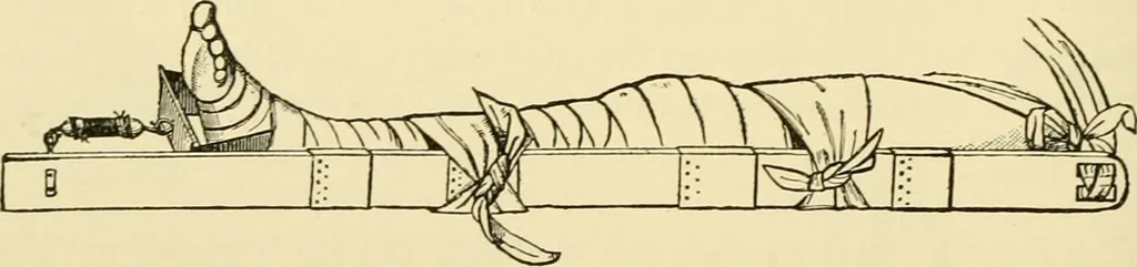 An illustration from Surgical technic; a text-book on operative surgery / by Fr. von Esmarch ... and E. Kowalzig ... translated by Professor Ludwig H. Grau ... and Willam N. Sullivan ... edited by Nicholas Senn ... With fourteen hundred and ninety-seven illustrations and fifteen colored plates., 1901, leaf 198