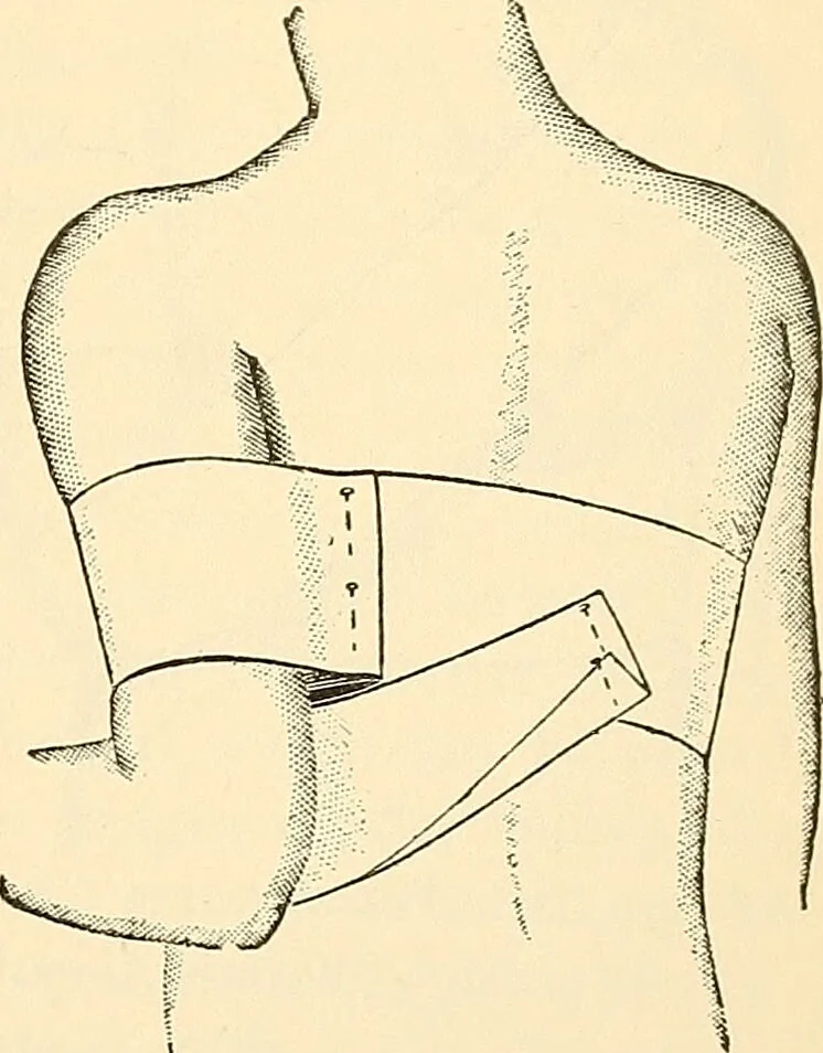 An illustration from Surgical technic; a text-book on operative surgery / by Fr. von Esmarch ... and E. Kowalzig ... translated by Professor Ludwig H. Grau ... and Willam N. Sullivan ... edited by Nicholas Senn ... With fourteen hundred and ninety-seven illustrations and fifteen colored plates., 1901, leaf 199