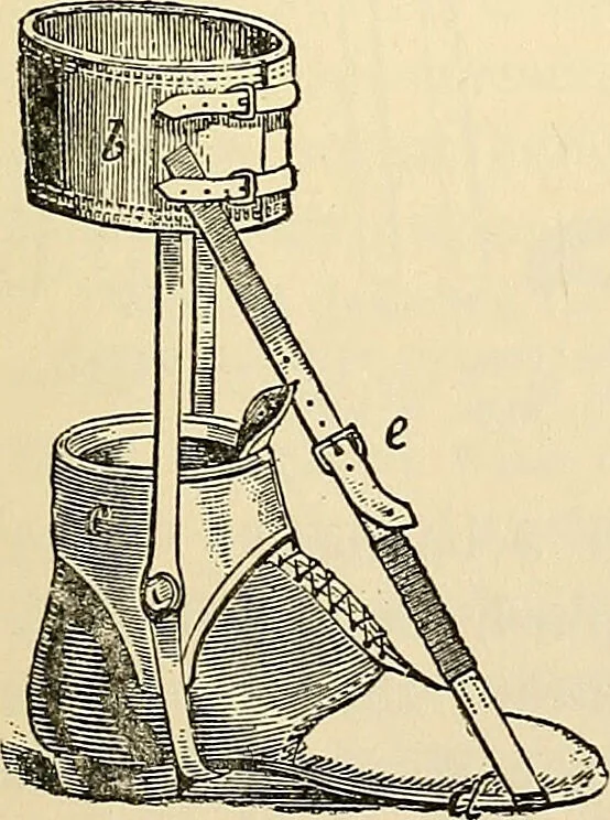 An illustration from Surgical technic; a text-book on operative surgery / by Fr. von Esmarch ... and E. Kowalzig ... translated by Professor Ludwig H. Grau ... and Willam N. Sullivan ... edited by Nicholas Senn ... With fourteen hundred and ninety-seven illustrations and fifteen colored plates., 1901, leaf 201