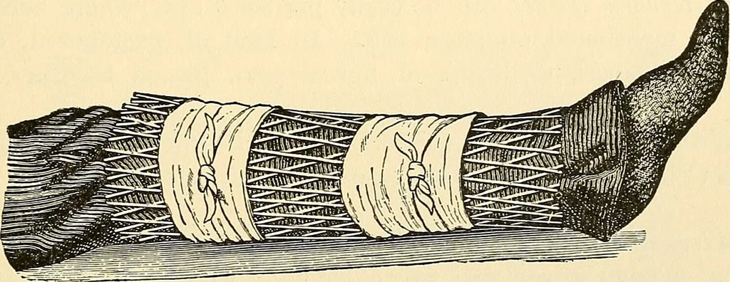 An illustration from Surgical technic; a text-book on operative surgery / by Fr. von Esmarch ... and E. Kowalzig ... translated by Professor Ludwig H. Grau ... and Willam N. Sullivan ... edited by Nicholas Senn ... With fourteen hundred and ninety-seven illustrations and fifteen colored plates., 1901, leaf 205