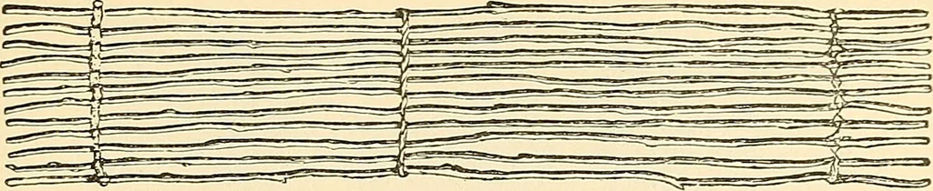 An illustration from Surgical technic; a text-book on operative surgery / by Fr. von Esmarch ... and E. Kowalzig ... translated by Professor Ludwig H. Grau ... and Willam N. Sullivan ... edited by Nicholas Senn ... With fourteen hundred and ninety-seven illustrations and fifteen colored plates., 1901, leaf 207