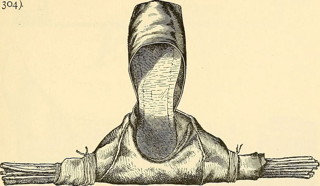 An illustration from Surgical technic; a text-book on operative surgery / by Fr. von Esmarch ... and E. Kowalzig ... translated by Professor Ludwig H. Grau ... and Willam N. Sullivan ... edited by Nicholas Senn ... With fourteen hundred and ninety-seven illustrations and fifteen colored plates., 1901, leaf 209