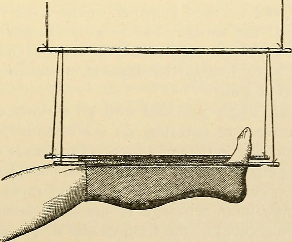 An illustration from Surgical technic; a text-book on operative surgery / by Fr. von Esmarch ... and E. Kowalzig ... translated by Professor Ludwig H. Grau ... and Willam N. Sullivan ... edited by Nicholas Senn ... With fourteen hundred and ninety-seven illustrations and fifteen colored plates., 1901, leaf 211