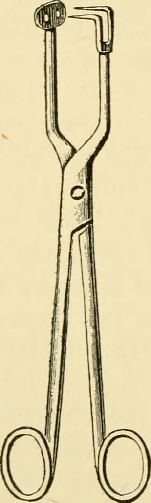 An illustration from Surgical technic; a text-book on operative surgery / by Fr. von Esmarch ... and E. Kowalzig ... translated by Professor Ludwig H. Grau ... and Willam N. Sullivan ... edited by Nicholas Senn ... With fourteen hundred and ninety-seven illustrations and fifteen colored plates., 1901, leaf 228