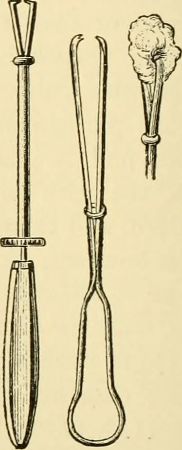 An illustration from Surgical technic; a text-book on operative surgery / by Fr. von Esmarch ... and E. Kowalzig ... translated by Professor Ludwig H. Grau ... and Willam N. Sullivan ... edited by Nicholas Senn ... With fourteen hundred and ninety-seven illustrations and fifteen colored plates., 1901, leaf 228