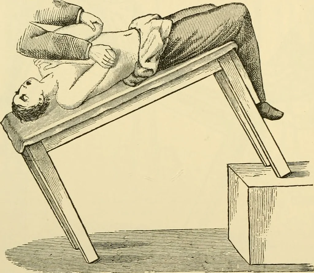 An illustration from Surgical technic; a text-book on operative surgery / by Fr. von Esmarch ... and E. Kowalzig ... translated by Professor Ludwig H. Grau ... and Willam N. Sullivan ... edited by Nicholas Senn ... With fourteen hundred and ninety-seven illustrations and fifteen colored plates., 1901, leaf 230