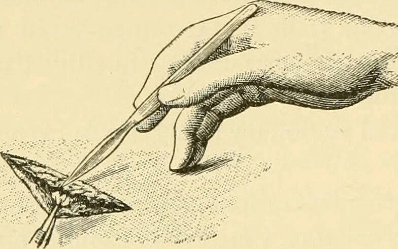 An illustration from Surgical technic; a text-book on operative surgery / by Fr. von Esmarch ... and E. Kowalzig ... translated by Professor Ludwig H. Grau ... and Willam N. Sullivan ... edited by Nicholas Senn ... With fourteen hundred and ninety-seven illustrations and fifteen colored plates., 1901, leaf 242