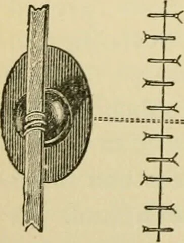 An illustration from Surgical technic; a text-book on operative surgery / by Fr. von Esmarch ... and E. Kowalzig ... translated by Professor Ludwig H. Grau ... and Willam N. Sullivan ... edited by Nicholas Senn ... With fourteen hundred and ninety-seven illustrations and fifteen colored plates., 1901, leaf 260