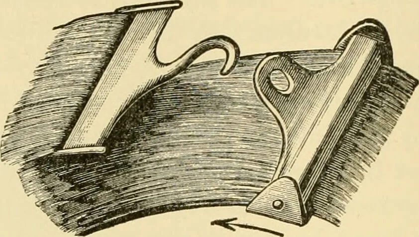 An illustration from Surgical technic; a text-book on operative surgery / by Fr. von Esmarch ... and E. Kowalzig ... translated by Professor Ludwig H. Grau ... and Willam N. Sullivan ... edited by Nicholas Senn ... With fourteen hundred and ninety-seven illustrations and fifteen colored plates., 1901, leaf 270