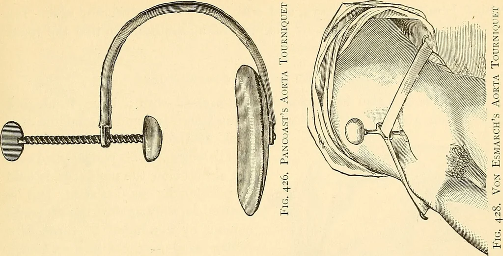 An illustration from Surgical technic; a text-book on operative surgery / by Fr. von Esmarch ... and E. Kowalzig ... translated by Professor Ludwig H. Grau ... and Willam N. Sullivan ... edited by Nicholas Senn ... With fourteen hundred and ninety-seven illustrations and fifteen colored plates., 1901, leaf 283