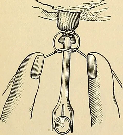 An illustration from Surgical technic; a text-book on operative surgery / by Fr. von Esmarch ... and E. Kowalzig ... translated by Professor Ludwig H. Grau ... and Willam N. Sullivan ... edited by Nicholas Senn ... With fourteen hundred and ninety-seven illustrations and fifteen colored plates., 1901, leaf 289