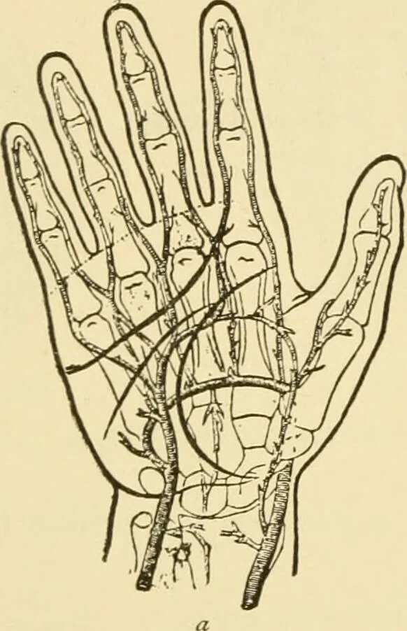 An illustration from Surgical technic; a text-book on operative surgery / by Fr. von Esmarch ... and E. Kowalzig ... translated by Professor Ludwig H. Grau ... and Willam N. Sullivan ... edited by Nicholas Senn ... With fourteen hundred and ninety-seven illustrations and fifteen colored plates., 1901, leaf 322