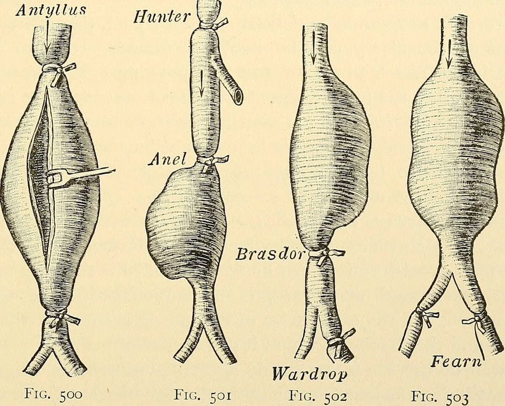 An illustration from Surgical technic; a text-book on operative surgery / by Fr. von Esmarch ... and E. Kowalzig ... translated by Professor Ludwig H. Grau ... and Willam N. Sullivan ... edited by Nicholas Senn ... With fourteen hundred and ninety-seven illustrations and fifteen colored plates., 1901, leaf 349
