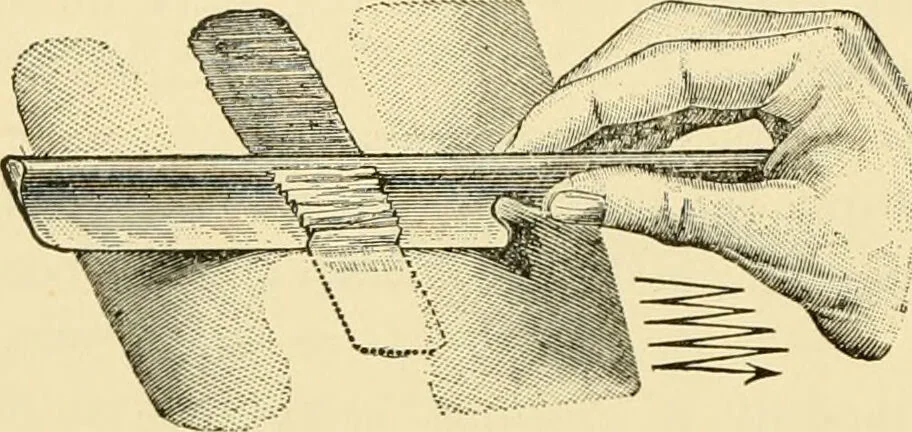 An illustration from Surgical technic; a text-book on operative surgery / by Fr. von Esmarch ... and E. Kowalzig ... translated by Professor Ludwig H. Grau ... and Willam N. Sullivan ... edited by Nicholas Senn ... With fourteen hundred and ninety-seven illustrations and fifteen colored plates., 1901, leaf 364