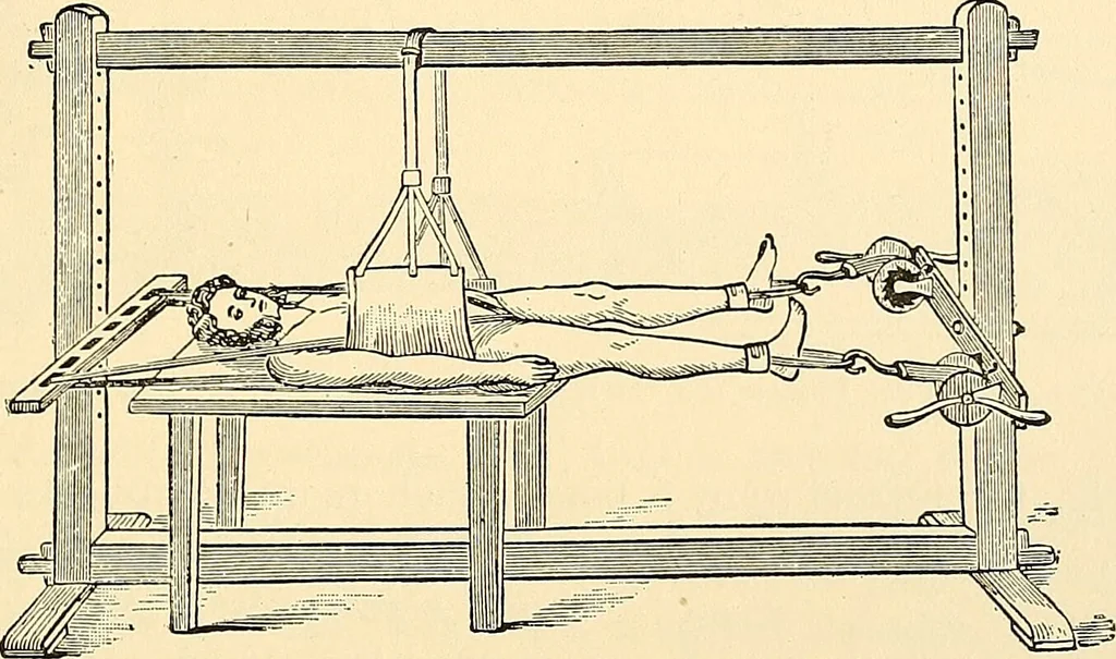 An illustration from Surgical technic; a text-book on operative surgery / by Fr. von Esmarch ... and E. Kowalzig ... translated by Professor Ludwig H. Grau ... and Willam N. Sullivan ... edited by Nicholas Senn ... With fourteen hundred and ninety-seven illustrations and fifteen colored plates., 1901, leaf 369