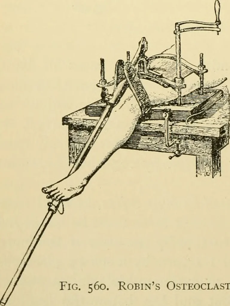 An illustration from Surgical technic; a text-book on operative surgery / by Fr. von Esmarch ... and E. Kowalzig ... translated by Professor Ludwig H. Grau ... and Willam N. Sullivan ... edited by Nicholas Senn ... With fourteen hundred and ninety-seven illustrations and fifteen colored plates., 1901, leaf 370