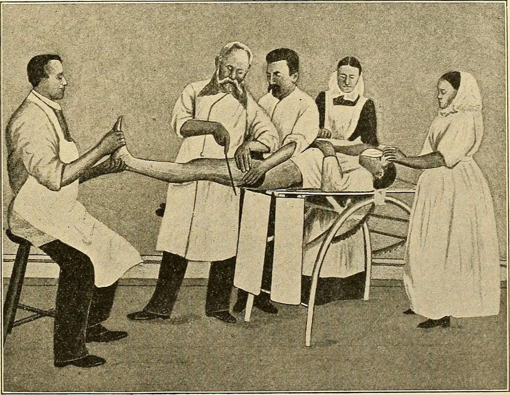 An illustration from Surgical technic; a text-book on operative surgery / by Fr. von Esmarch ... and E. Kowalzig ... translated by Professor Ludwig H. Grau ... and Willam N. Sullivan ... edited by Nicholas Senn ... With fourteen hundred and ninety-seven illustrations and fifteen colored plates., 1901, leaf 381