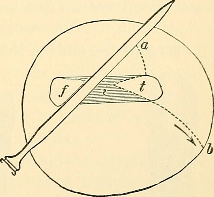 An illustration from Surgical technic; a text-book on operative surgery / by Fr. von Esmarch ... and E. Kowalzig ... translated by Professor Ludwig H. Grau ... and Willam N. Sullivan ... edited by Nicholas Senn ... With fourteen hundred and ninety-seven illustrations and fifteen colored plates., 1901, leaf 393