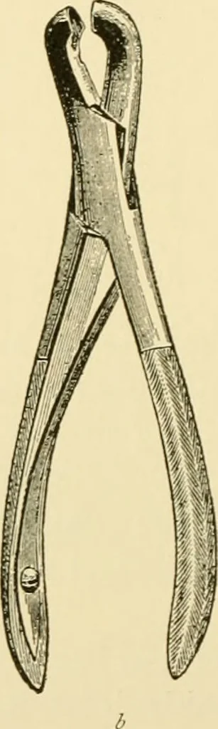 An illustration from Surgical technic; a text-book on operative surgery / by Fr. von Esmarch ... and E. Kowalzig ... translated by Professor Ludwig H. Grau ... and Willam N. Sullivan ... edited by Nicholas Senn ... With fourteen hundred and ninety-seven illustrations and fifteen colored plates., 1901, leaf 394