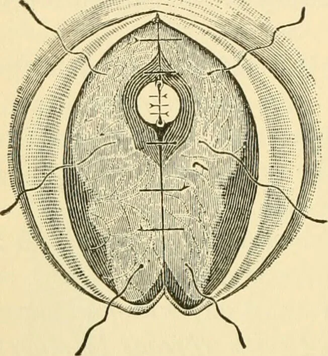 An illustration from Surgical technic; a text-book on operative surgery / by Fr. von Esmarch ... and E. Kowalzig ... translated by Professor Ludwig H. Grau ... and Willam N. Sullivan ... edited by Nicholas Senn ... With fourteen hundred and ninety-seven illustrations and fifteen colored plates., 1901, leaf 396