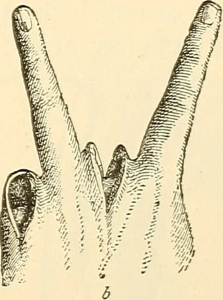An illustration from Surgical technic; a text-book on operative surgery / by Fr. von Esmarch ... and E. Kowalzig ... translated by Professor Ludwig H. Grau ... and Willam N. Sullivan ... edited by Nicholas Senn ... With fourteen hundred and ninety-seven illustrations and fifteen colored plates., 1901, leaf 403