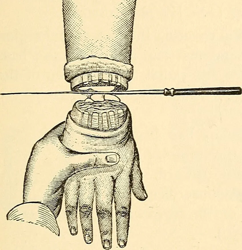 An illustration from Surgical technic; a text-book on operative surgery / by Fr. von Esmarch ... and E. Kowalzig ... translated by Professor Ludwig H. Grau ... and Willam N. Sullivan ... edited by Nicholas Senn ... With fourteen hundred and ninety-seven illustrations and fifteen colored plates., 1901, leaf 407