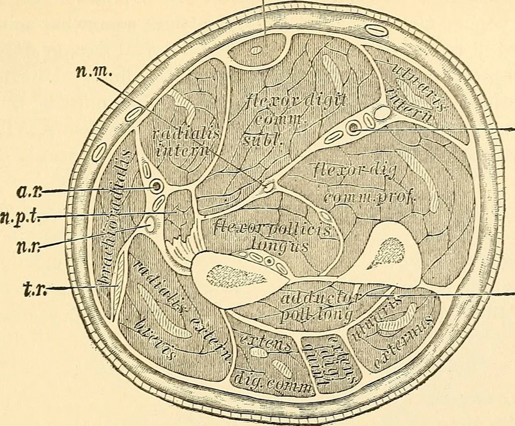 An illustration from Surgical technic; a text-book on operative surgery / by Fr. von Esmarch ... and E. Kowalzig ... translated by Professor Ludwig H. Grau ... and Willam N. Sullivan ... edited by Nicholas Senn ... With fourteen hundred and ninety-seven illustrations and fifteen colored plates., 1901, leaf 411