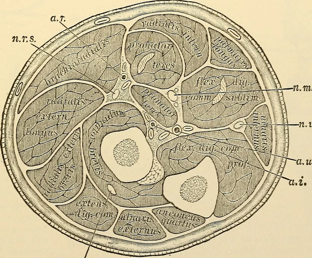 An illustration from Surgical technic; a text-book on operative surgery / by Fr. von Esmarch ... and E. Kowalzig ... translated by Professor Ludwig H. Grau ... and Willam N. Sullivan ... edited by Nicholas Senn ... With fourteen hundred and ninety-seven illustrations and fifteen colored plates., 1901, leaf 411
