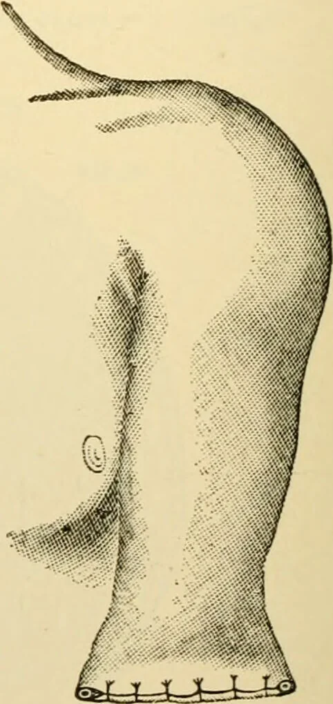 An illustration from Surgical technic; a text-book on operative surgery / by Fr. von Esmarch ... and E. Kowalzig ... translated by Professor Ludwig H. Grau ... and Willam N. Sullivan ... edited by Nicholas Senn ... With fourteen hundred and ninety-seven illustrations and fifteen colored plates., 1901, leaf 412